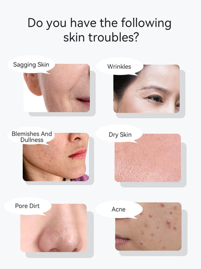 ANLAN EMS Facial Massager Pro Skin Lifting Device