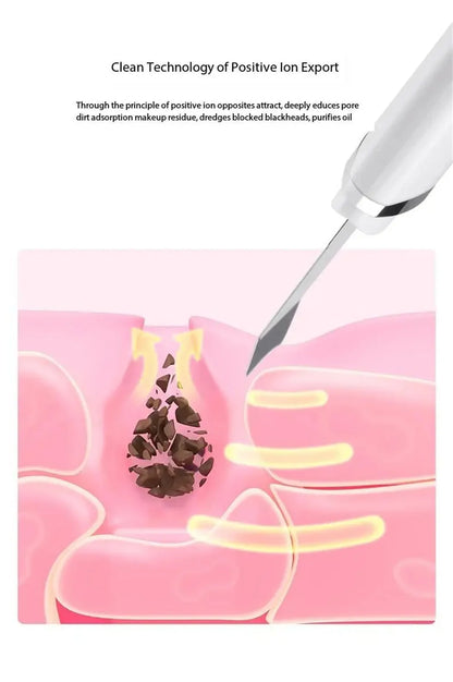Electric Blackhead Vacuum Pore Cleaner Beauty Device