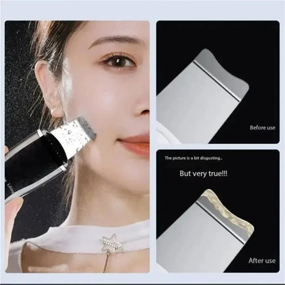 Electric Blackhead Vacuum Pore Cleaner Beauty Device